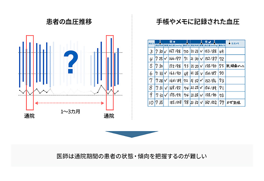 オムロンが”遠隔診療サービス”に取り組む理由