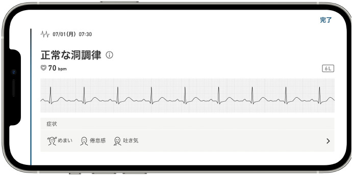 アプリ画面