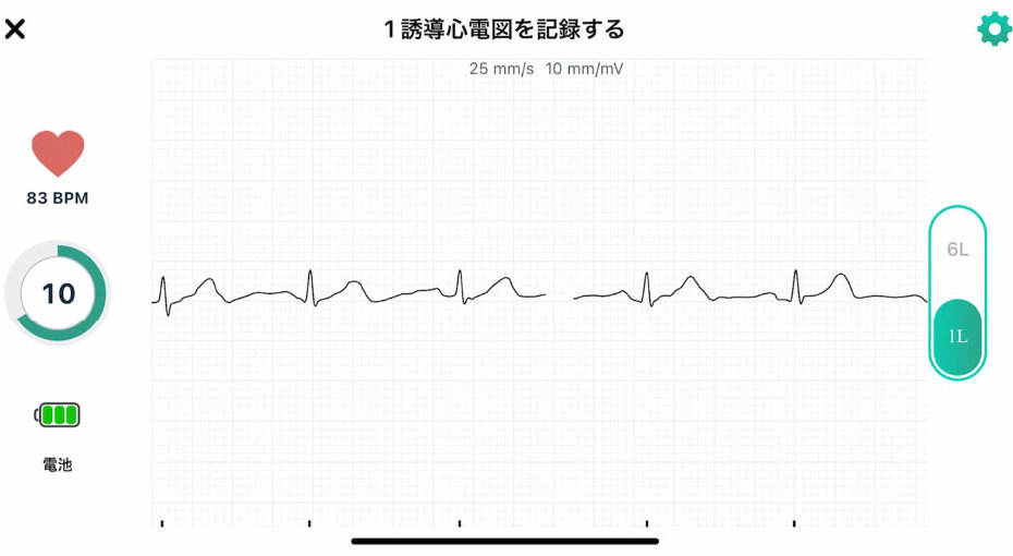 心電図イメージ