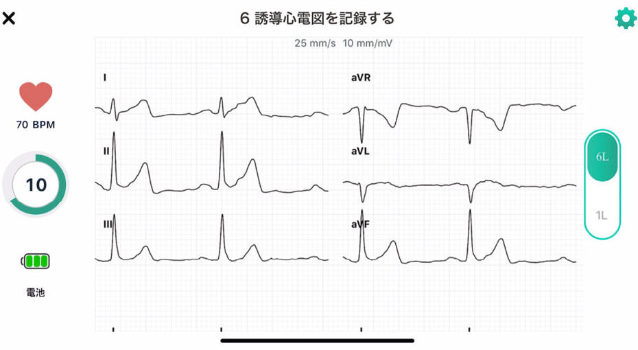 心電図イメージ