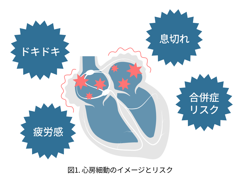 図1.心房細動のイメージとリスク