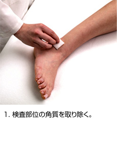 1. 検査部位の角質を取り除く。