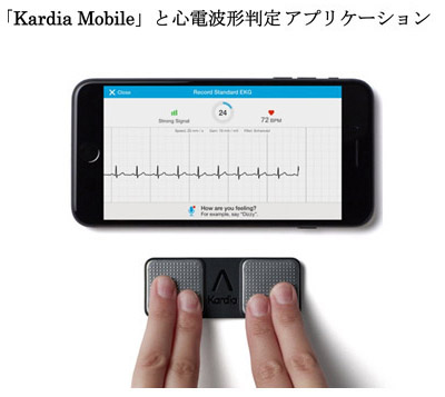 「Kardia Mobile」と心電波形判定アプリケーション