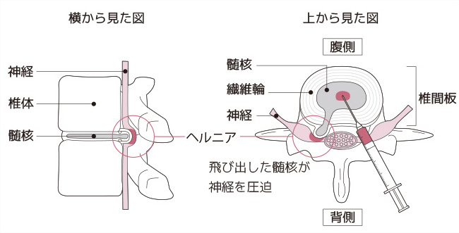 横から見た図 上から見た図