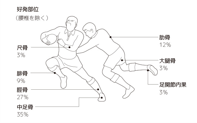 疲労骨折とは何か 起こる原因と部位 予防法など 骨折の痛み 痛みwith