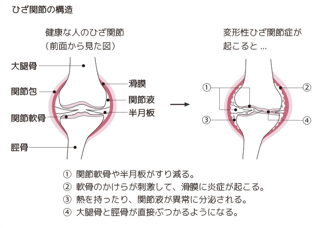 ひざ関節の構造