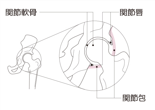 肩関節の損傷と肩関節唇損傷 腱板断裂 肩の痛みの種類 肩の痛み 痛みwith