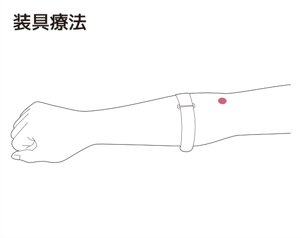 外側上顆炎 テニス肘と呼ばれる肘の外側の痛み の症状 原因と予防法 スポーツによる慢性の痛み 痛みwith