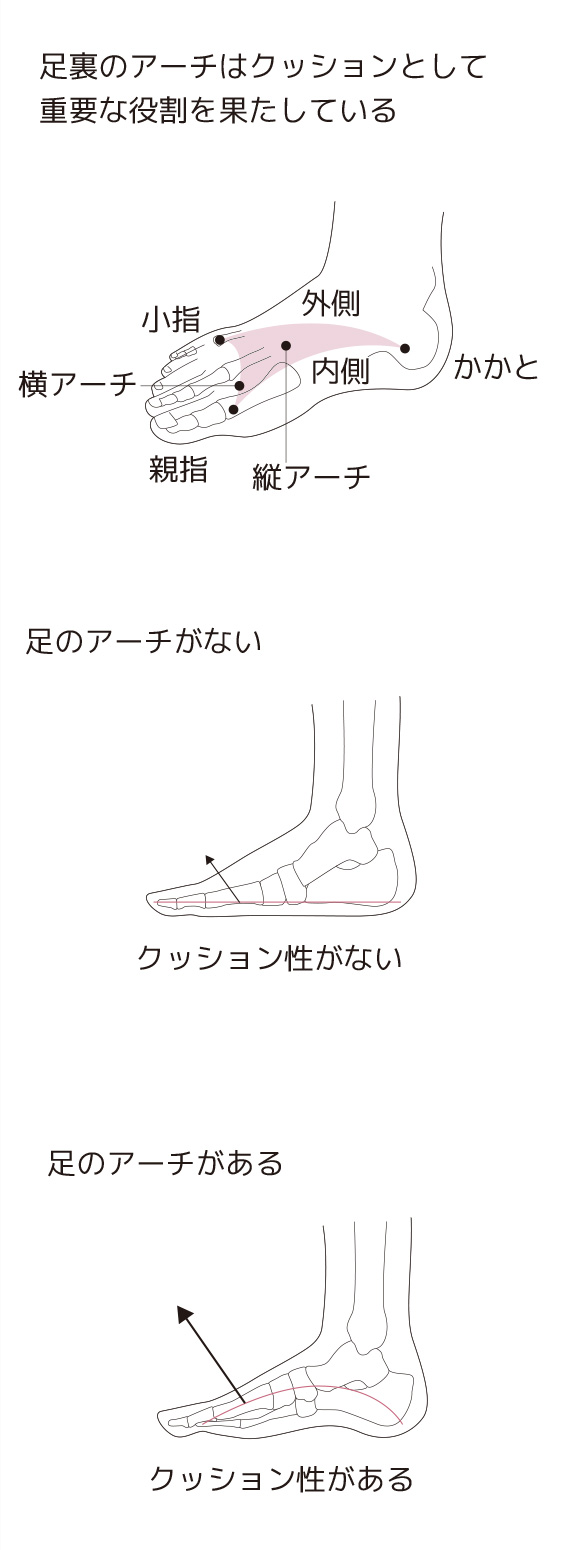 足底腱膜炎の症状 原因と予防法 ランニング中に多い足底 足裏 の痛み スポーツによる慢性の痛み 痛みwith