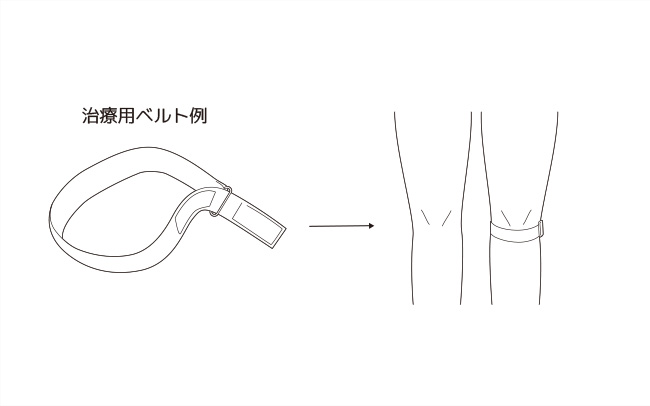 治療用ベルト例