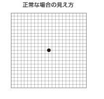 正常な場合の見え方