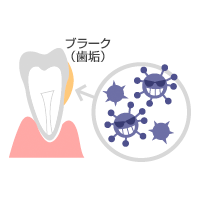 vol.12 歯周病を治して心臓疾患を予防する