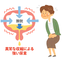 過活動膀胱の新しい治療薬と薬物治療 健康 医療トピックス オムロン ヘルスケア