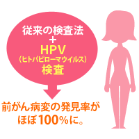 vol.111 高い発見率で注目される、子宮頸がんの「ＨＰＶ併用検診」