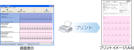 オムロン心電図印刷ソフト HCG-SOFT-2｜お客様サポート｜オムロン