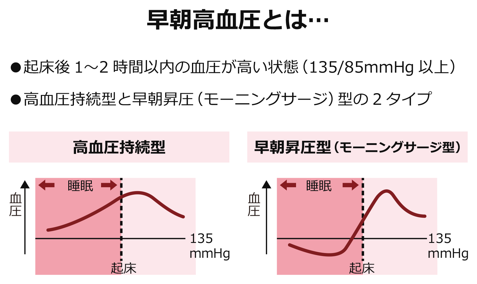 早朝高血圧とリスクについて…